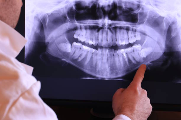 Best Pediatric Emergency Dentist in Mount Angel, OR